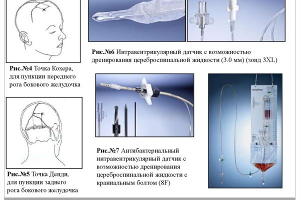 Kraken вход и ссылки